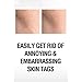 SkinPro Skin Tag Remover And Mole Corrector For Fast Removal Of Skin Moles, Skin Tags, Warts And Other Minor Growths, Medical Grade Formula with 17% Salicylic Acid (1 fl oz, 30 ml)