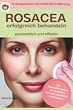 Rosacea erfolgreich behandeln - ganzheitlich und effektiv: Der Selbsthilferatgeber für Betroffene mit Tipps, die wirklich funktionieren (Heilkraft Ernährung, Band 10)