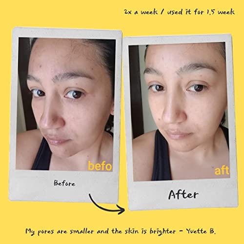 Fytt Boost Energy Brightening Exfoliating Mask And Body Scrub | 100% Plant-Based, Vegan & Gluten-Free | Dark Spot Remover | Acne Scars | Skin Care Routine #TOP6