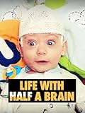 Life with Half a Brain