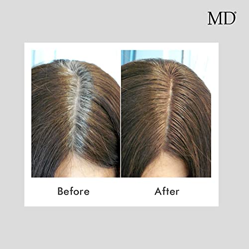 MD Hair Color Restoration 1.7 fl. oz. para cabello y barba miniatura 6