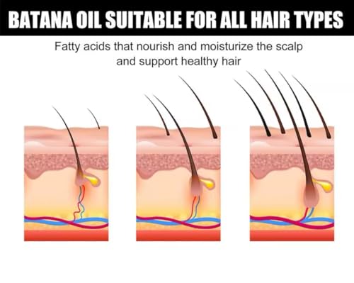 Eelhoe Batana Oil for Hair Growth, 2.02 fl oz, Hair Thickening Treatment with Vitamin E - Thumbnail 7