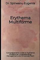 Comprehensive Guide to Erythema Multiforme: Understanding, Management, and Empowerment B0D4KDCZYC Book Cover