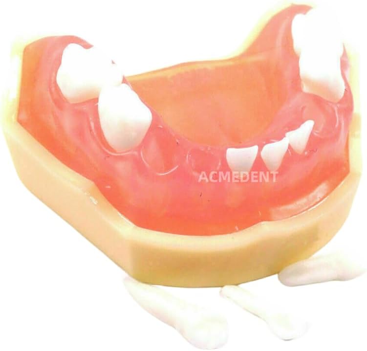 Children First Teeth Model Removable Kids Tooth Brush Dental Pediatric Soft Gum