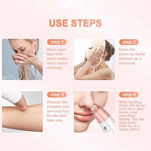 Blackhead Remover Vacuum-Blackhead Remover Tool For Men And Women Pore Cleaner, Usb Interface Type Pore Vacuum,3 Adjustment Modes & 6 Suction Heads #TOP5