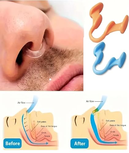 Image of 6 Pcs Anti Snoring Device - Nose Clip Snoring Stopper Anti Snore Reusable Device for a Peaceful Night's Sleep, Snore Free Nose Clip for Men & Women