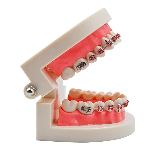 Standard Tooth Teaching Mallocclusion Orthodontic Teeth Model With Brackets Archwire Buccal Tube Tool #TOP3