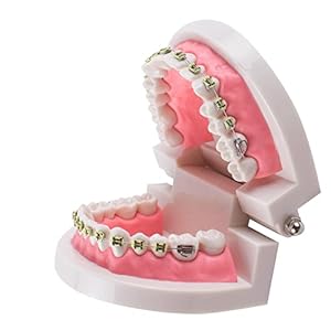 Yuland Standard Typodont Demonstration Teeth Model with Brackets for Dental Teach Study
