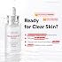 TIRTIR Azelaic Acid 12% Serum for Blemish-Prone Skin - Lightweight Hydrating Formula with Zinc PCA & Hyal-ZIP, Non-Comedogenic, Fragrance-Free, 30ml / 1.01 Fl Oz