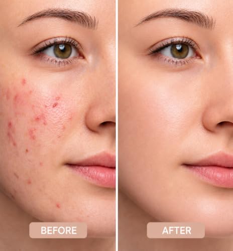 Image of Clinical 0.2% Retinaldehyde Face Serum 50ml - Fast Anti Aging Retinal Skin Booster with Ectoin & Cica - Gentle Retinol Alternative Cream Gel for Fine Lines, Dark Spots, Deep Wrinkles, Acne Scars