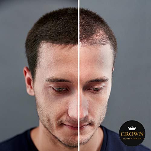 CROWN HAIR FIBERS for Thinning Hair (BLACK) - Instantly Thickens Thinning or Balding Hair for Men & Women - 2x Large 0.87oz/25g Bottle - Best Natural Keratin Hair Loss Concealer