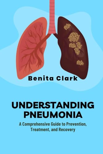 UNDERSTANDING PNEUMONIA: A Comprehensive Guide to Prevention, Treatment, and Recovery