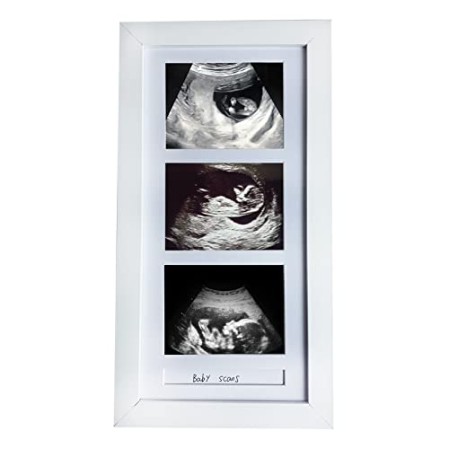 Image of Triple Baby Sonogram Photo Frame (White)