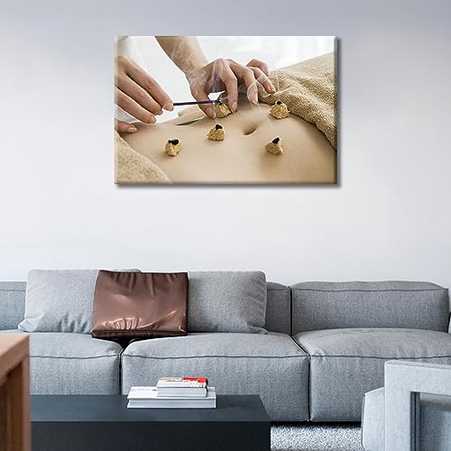 Image of Posters & Prints 1 Panels Nosocomium Paintings Wall Art Moxibustion Art Prints Framed Wall Art Nosocomium Giclee Wooden Framed Gallery-Wrapped Ready to Hang (16 inch Wx24 H)