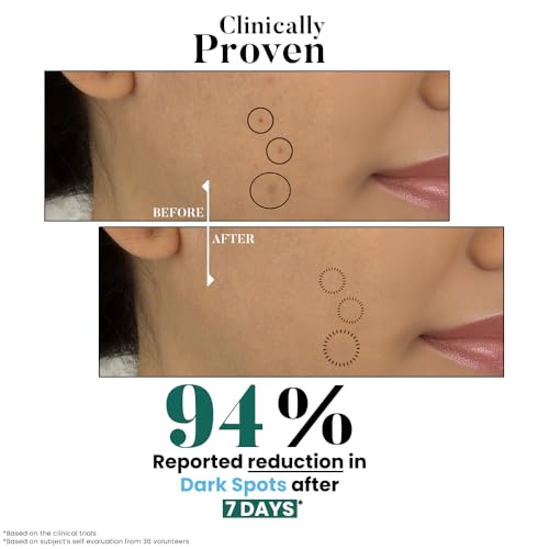 Image of Bio Code 1.5% Alpha Arbutin Brightening Moisturizer (100ml) - with 1% Tranexamic Acid, 1% Licorice & 2% Niacinamide | For Even Tone & Deep Hydration | AI-Enhanced Formula | Dermatologist Recommended