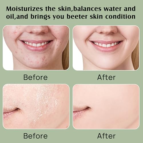 image for YBHMO Beef Tallow Moisturizer,Beef Tallow for Skin,Organic Grass Fed B