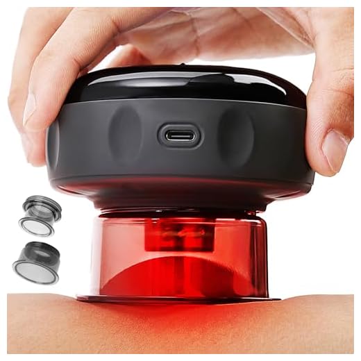 41JkD+feJ7L._SS520_ Best cupping equipment