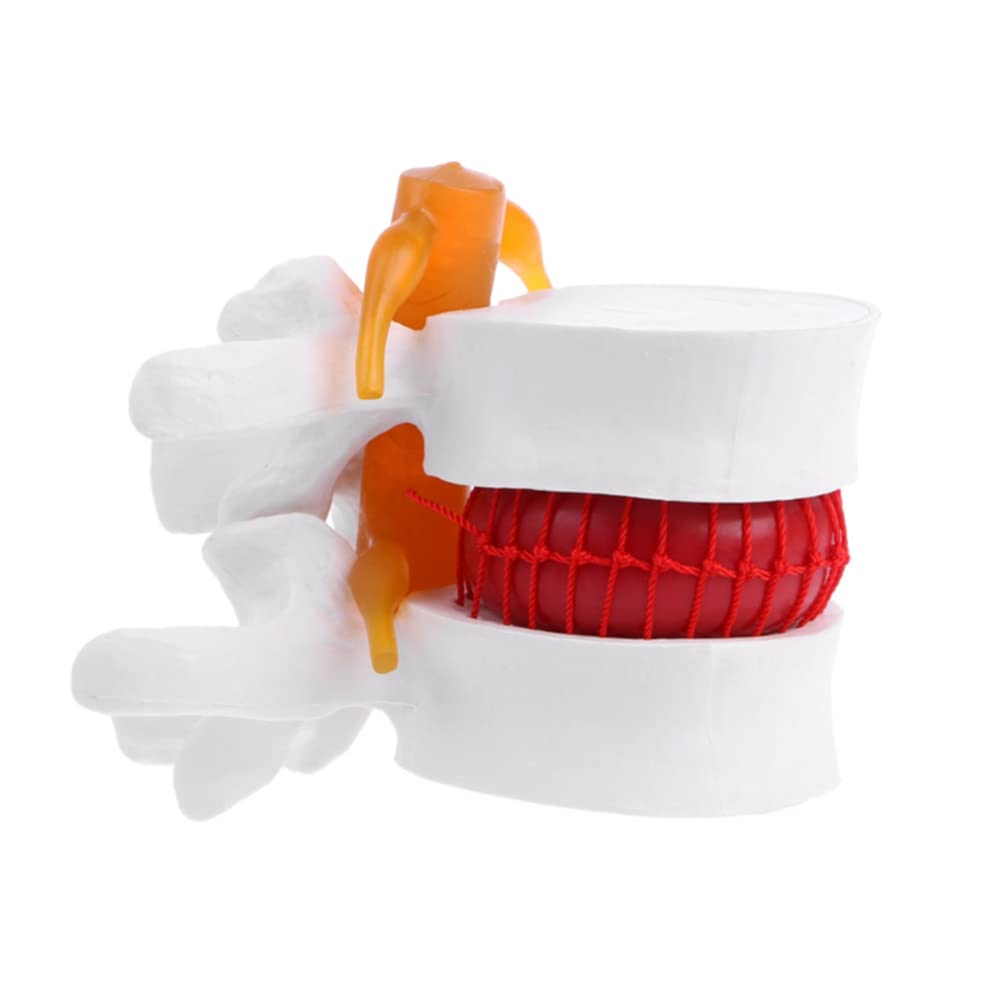 Buy Human Lumbar Vertebra Demonstration Model Lumbar Spine