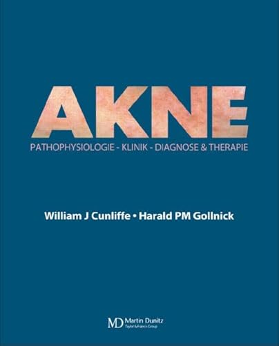 Preisvergleich Produktbild Acne: Diagnose und Therapie