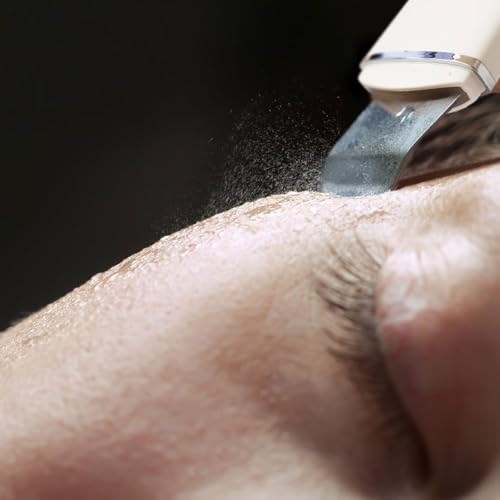 Detergente per la pelle del viso ad ultrasuoni, strumento per la pulizia della pelle, strumento per la rimozione dei punti neri, dispositivo esfoliante e pulizia dei pori, ricaricabile tramite USB