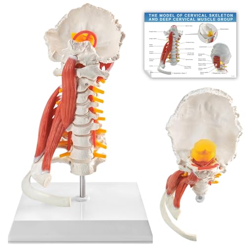 Image of EVOTECH SCIENTIFIC Cervical Spine Anatomical Model with Brainstem, Muscles, Thoracic Vertebrae & Nerves - Life-Size Human Neck Vertebrae Model for Medical Teaching, Chiropractic, and Anatomy Study