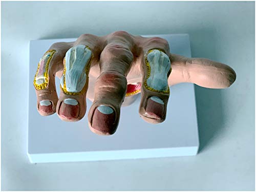 Amazon.co.jp: 手のひらの解剖学モデル - 人間の痛みを伴う風石の解剖