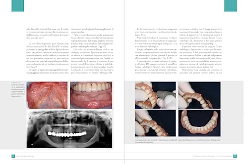 Digital Implantology - 6