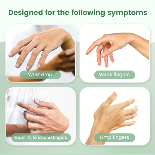 Radial Nerve Palsy Brace Splint for Finger Extension, Wrist Drop, Crutch Palsy, Mcp Arthroplasty, Radial Nerve Injury, Finger Limp, Stroke Recovery, Adjustable Hand Stabilizer fit Right & Left Hand - Image 3