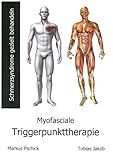 Myofasciale Triggerpunkttherapie: Schmerzsyndrome gezielt behandeln