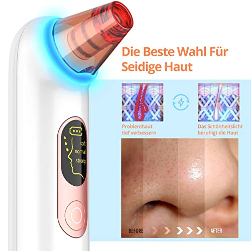 Wohlman pro Mitesserentferner Porenreiniger Vakuumsauger, 4 Funktionsköpfe, 3 Modi, LED-Bildschirm und geräuscharmes… - Image 3