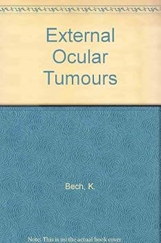 Hardcover External ocular tumors: A clinicopathologic study of 300 cases : textbook and atlas Book