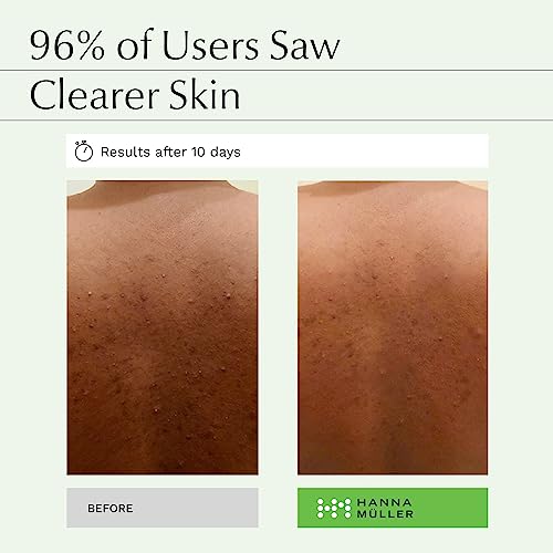 𝗪𝗜𝗡𝗡𝗘𝗥 𝟮𝟬𝟮𝟯* Tea Tree Body Wash, Natural Body Wash With 5% Australian Tea Tree Oil & Aloe Vera For Clean, Hydrated Skin, Steam-Distilled Acne Body Wash To Help Reduce Acne, Blemishes & Odor #TOP1
