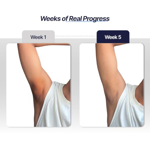Image of Mannlich Underarm Roll-On for Men, 2% Kojic & Salicylic Acid, Lactic Acid, Alpha Arbutin, 4% AHA & BHA | Brightens Skin, Reduces Pigmentation, Exfoliates & Prevents Body Odor | Alcohol & Aluminum Free, Dermatologically Tested- 50ml (Pack of 3)