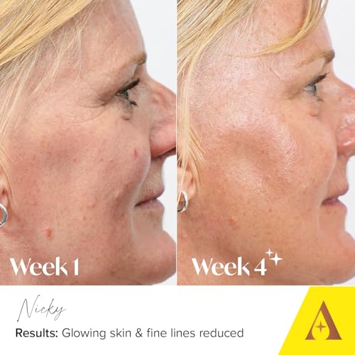 Absolute Collagen Deep Lift Night Cream 50ml - Nourishing & Hydrating - Repair & Restore Skin Barrier - Improves Skin Texture, Elasticity & Firmness - Reduce Appearance of Fine Lines - Anti-Ageing - Image 6