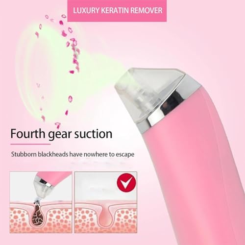 Luxury Confidence Keratin Remover Blackhead Remover Pore Vacuum Electric Face Vacuum Pore Cleaner White Heads Removal with 3 Modes and 4 Suction Heads Nose Hair Removal (Pink+White, One Size) - Image 5