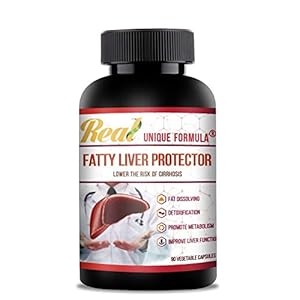 Top Liver Detox Herbal | Fatty Liver Supplement, Support and Cleanse with Unique Formula of Artichoke Leaf, Milk Thistle, Curcumin Turmeric, Buckwheat, Burdock Methionine, Betaine (90 Capsules)