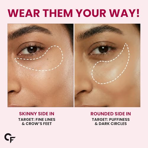 Image of Carbamide Forte Hydrogel Under Eye Patches For Dark Circles | Under Eye Mask with Caffeine, Rose Extract, Niacinamide | Reduces Dark Circles & Puffiness | Hydrating & Brightening Eye Patches | 60 Patches (30 Pairs)
