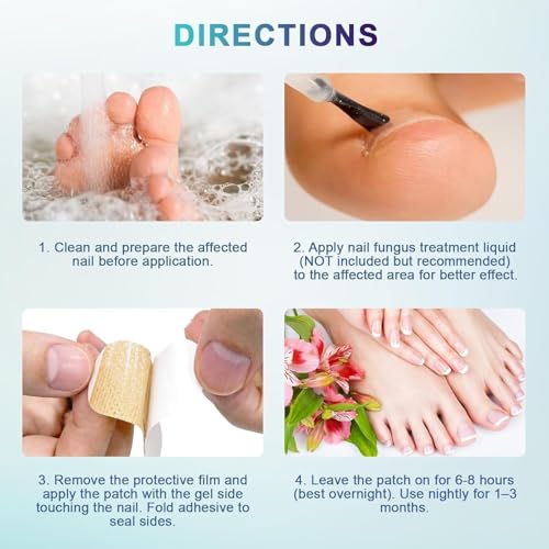 Image of Advanced Fungal Nail Patch Treatment - Powerful Antifungal Solution | Targets Nail Fungus at the Root | Easy-to-Use Patch for Toenail & Fingernail (Pack Of 1)