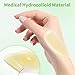 ZnnaYoha 20Pcs Stoma Barrier Strips,Medical Grade Hydrocolloid Skin Extender Strips for Colostomy Bags,Skin Adhesive Ostomy Barrier Tape for Colostomy Stoma Bags