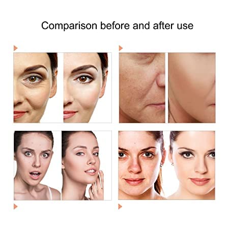 Kostech LED Face Mask, 7Color PDT LED Photon Lamp Facial Body Therapy Touch Screen Face Whitening Skin Care Rejuvenation Beauty Equipment - Image 3