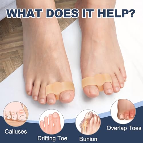 Image of Promifun Gel Toe Corrector, 10 Pack of Toe Separators with 2 Loops, Big Toes Spacer for Bunion Pain and Overlapping Toe - Beige