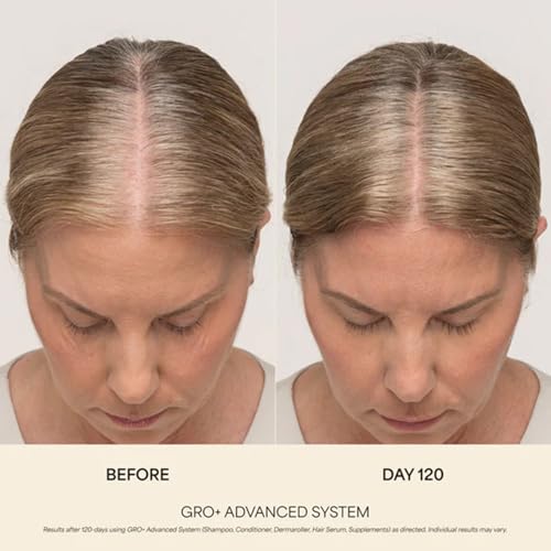 VEGAMOUR GRO+ Advanced Hair Serum for Density & Scalp Health 1oz — view 8