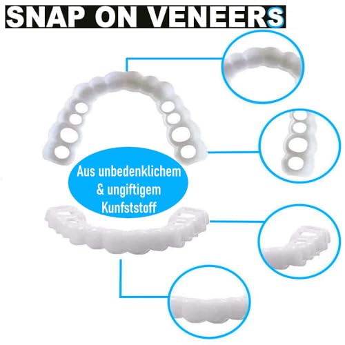 Zahnblende Mavura SnapOnVeneers Kosmetische Zahnprothese