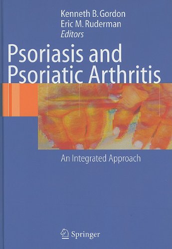 Psoriasis and Psoriatic Arthritis: An Integrated Approach: Kenneth B ...