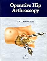 Operative Hip Arthroscopy 0865776792 Book Cover
