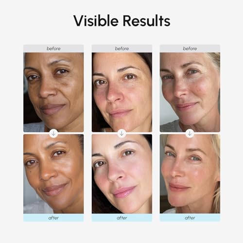 MAREE Face Moisturizer Retinol Cream for Face - Daily Wrinkle Cream for Women - Anti Aging Face Cream - Facial Moisturizer with Collagen - Crema Hidratante Para la Cara for Skin Tightening