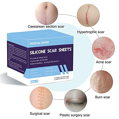 Medical Grade Scar Removal Silicone Tape(0.8X60''Roll)For Hypertrophic Scars Keloids Caused By Surgery, Injury, Burns, C-Section,Crease(Per 2"/Roll) #TOP2
