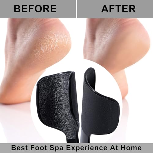 Beomeen BME063B Curved Foot File Callus Remover thumb #3