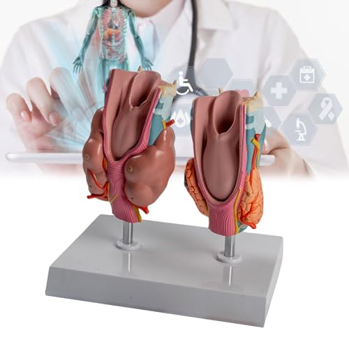 Modèle de thyroïde pathologique pour simulation de démonstration clinique
