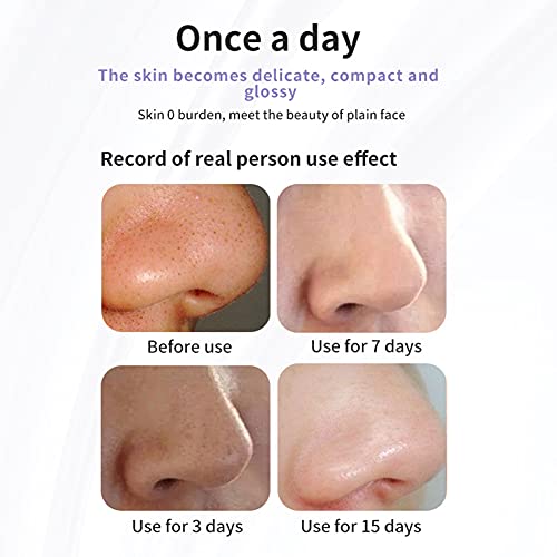 Ikasus Aspiratore Punti Neri,Aspiratore Punti Neri...